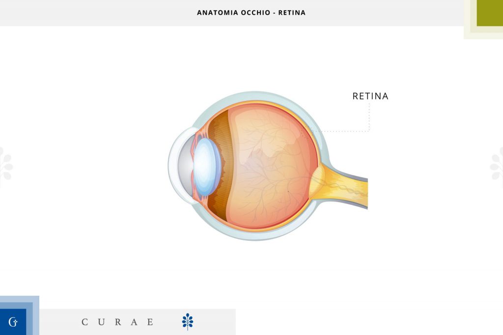 distacco retina