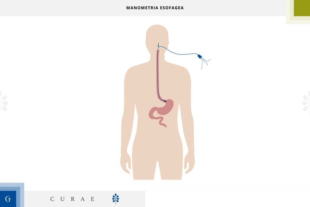 manometria esofagea
