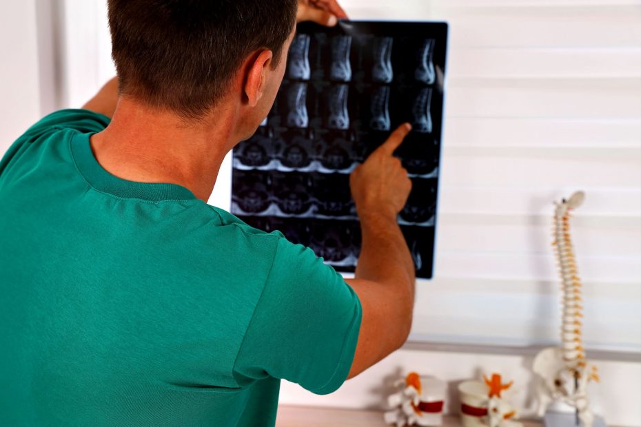 radiografie colonna vertebrale roma
