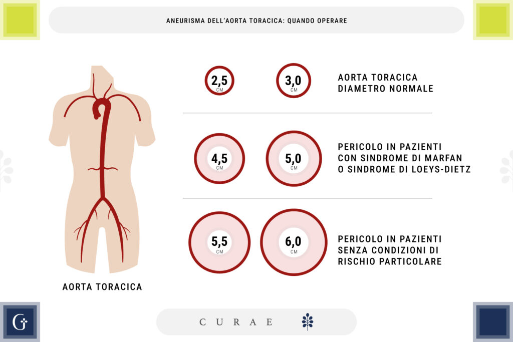 aneurisma aorta toracica quando operare