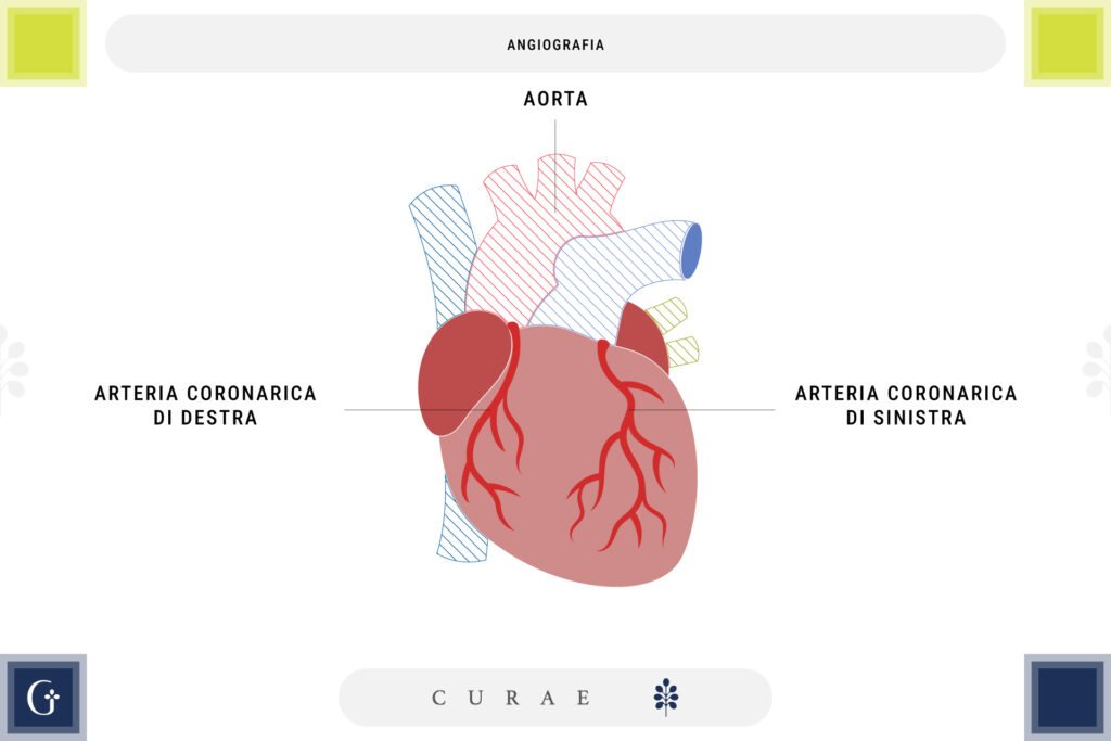 angiografia