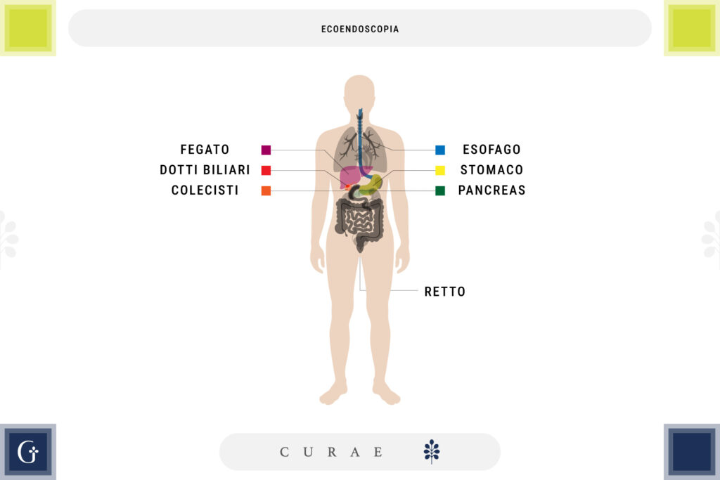 ecoendoscopia