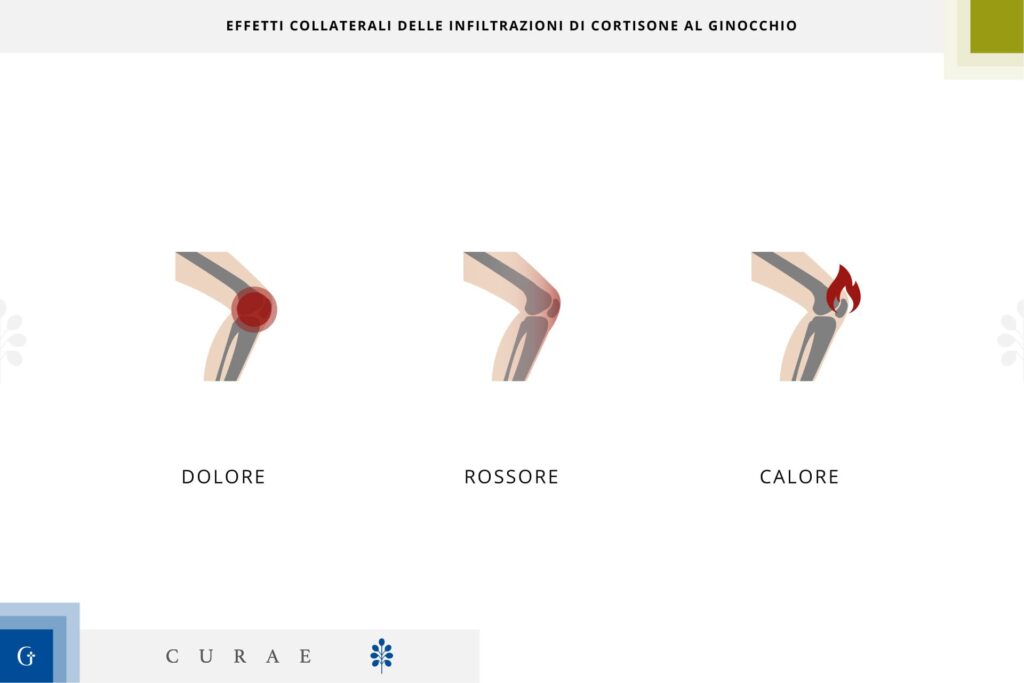 infiltrazioni ginocchio cortisone