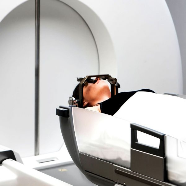 meningioma roma