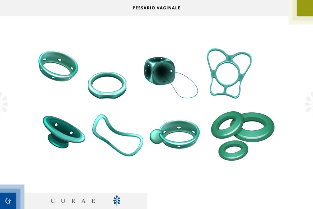 pessario vaginale