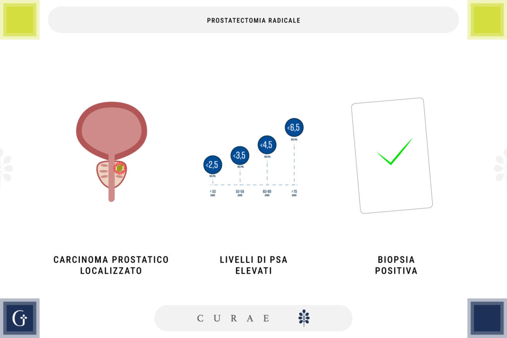 prostatectomia radicale