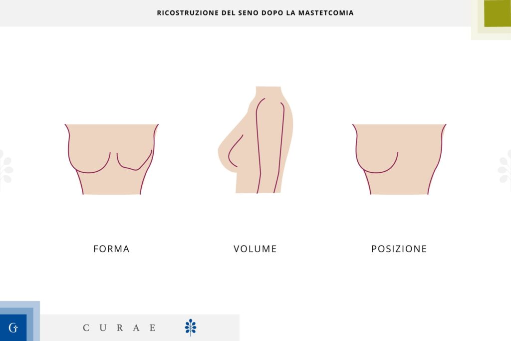 ricostruzione del seno