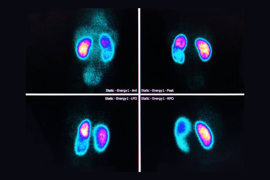 scintigrafia renale roma