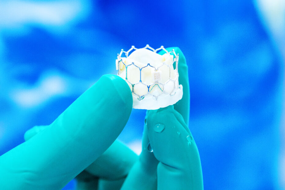 sostituzione valvola mitralica rischi roma