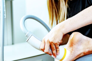 spina calcaneare onde d urto a roma