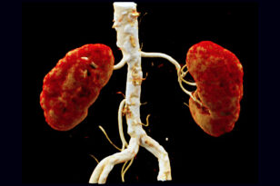 urotac senza contrasto roma